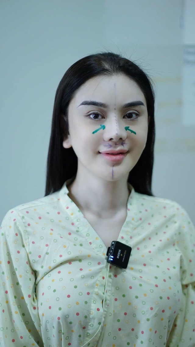Phẫu thuật thẩm mỹ với chi phí lớn năm 2023