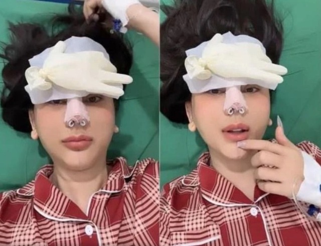 Phẫu thuật thẩm mỹ để thay đổi diện mạo