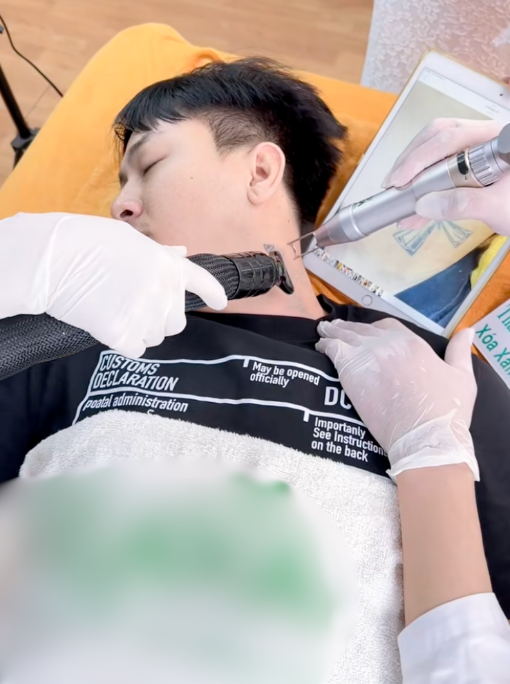 Hoài Lâm quyết định xoá hình xăm sau nhiều năm