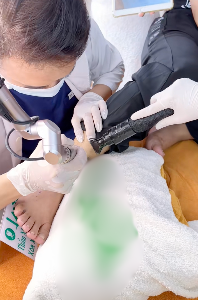 Nam ca sĩ thực hiện xoá xăm từ cổ đến chân bằng laser