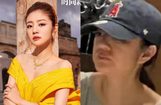 An Dĩ Hiên lộ dấu hiệu suy kiệt với gương mặt sưng phồng, làn da lão hóa